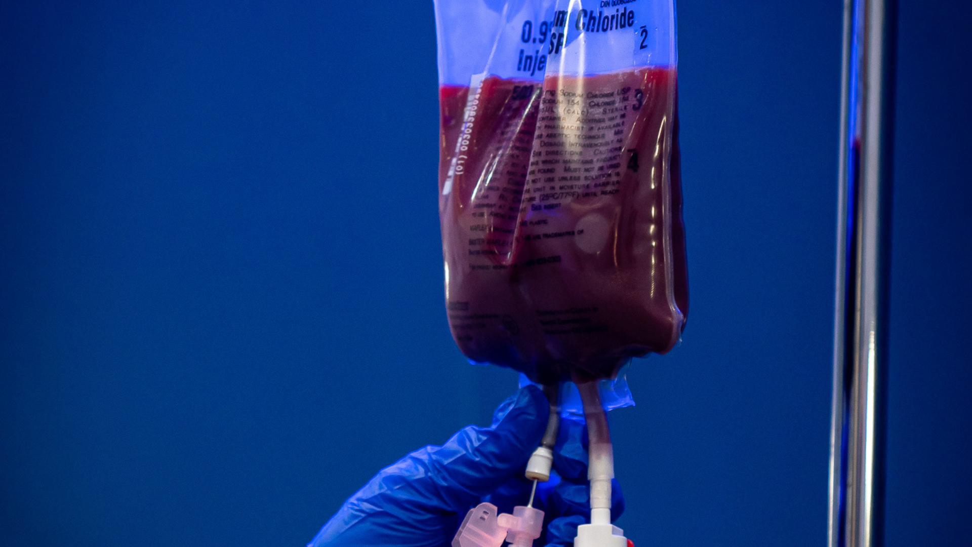 Ozone UV IV therapy treatment for immune support and detoxification